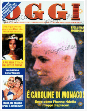 caroline-de-monaco-chauve-et-malade-drame-passe-hante
