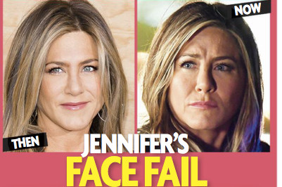 jennifer-aniston-visage-deforme-encore-un-desagreable-rate-chirurgical