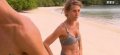 Chantal ( Koh-Lanta 2015) va mieux après avoir frôlé l'amputation (photo)