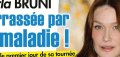 Carla Bruni-Sarkozy, une autre opération de la mâchoire prévue en avril