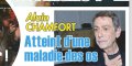 Alain Chamfort, drame, atteint d'une terrible maladie des os