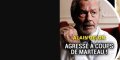  Alain Delon agressé à coups de marteau