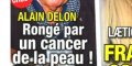 Alain Delon "isolé" dans le Loiret - Cancer de la peau - Implacable mise au point (photo)