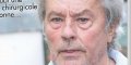 Alain Delon fragilisé mentalement après son opération secrète
