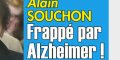 Alain Souchon, frappé par Alzheimer, il se bat courageusement