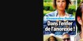 Alessandra Sublet dans l'enfer de l'anorexie, elle répond