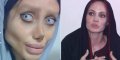 Angelina Jolie - Une fan devient zombie après 50 opérations pour lui ressembler