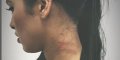 Ayem Nour blessée et battue, un anniversaire cauchemardesque, son accusation contre Vincent Micelet (photo)