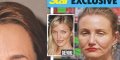 Cameron Diaz défigurée par le botox (photo)