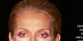 Céline Dion, maladie mystérieuse liée au vaccin anti-covid, révélation de Bob Kennedy Jr