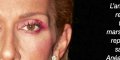 Céline Dion, mystérieuse pathologie liée au Covid - explication de Didier Raoult