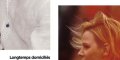 Charlène de Monaco, une opération de chirurgie esthétique loupée, une photo qui révèle la vérité