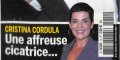 Cristina Cordula, une affreuse cicatrice