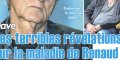 Dave, terribles révélations sur la maladie de Renaud