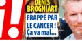 Denis Brogniart frappé par un cancer, ça va mal