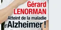 Gérard Lenorman dans l'enfer de l'Alzheimer, cette décision qui lui brise le coeur