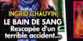 Ingrid Chauvin, horrible accident, une photo en dit long sur son état