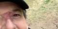 Jean-Luc Reichmann fin de cauchemar, fin d'enfer, il rassure sur son état (vidéo)