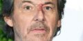 Jean-Luc Reichmann victime d'une maladie chronique ?, une perte de poids inquiétante ! 