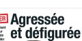 Jenifer, agressée et défigurée, son mari Ambroise calme ses ardeurs