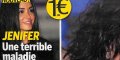 Jenifer, une terrible maladie