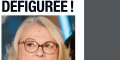 Josiane Balasko défigurée, elle n'osait plus sortir