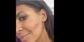 Karine Le Marchand blessée au visage, photo choc