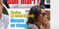 Karine Le Marchand blessée au visage, révélation sur son accident domestique
