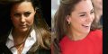 Kate Middleton adepte de chirurgie esthétique, ces « retouches » pratiquées à Londres