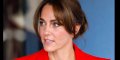Kate Middleton assume sa perte de cheveux, la princesse refuse de porter une perruque 