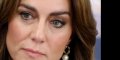 Kate Middleton, le flou autour de son hospitalisation, « C'est pire que le cancer ! »