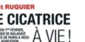 Laurent Ruquier, cicatrice à vie, « une terrible agression » en plein Paris