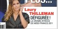 Laury Thilleman défigurée, le drame atroce de Miss France 2011