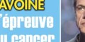 Marc Lavoine, l'épreuve du cancer, terrible traumatisme