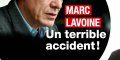 Marc Lavoine victime d'un grave accident, ses confidences