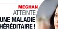 Meghan Markle souffre d'un mal incurable, même combat que Pierre Richard