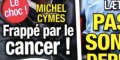 Michel Cymes, cancer, surprenante réponse (photo)