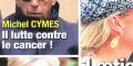 Michel Cymes, le choc, il lutte contre le cancer