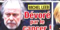 Michel Leeb dévoré par le cancer