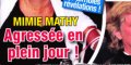 Mimie Mathy - Agression en plein jour - Un célèbre acteur dans le coup