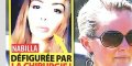 Nabilla Benattia défigurée par la chirurgie ?