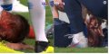 Olivier Giroud en sang après un violent choc contre les Etats-Unis (vidéo)