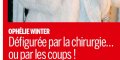 Ophélie Winter, défigurée par la chirurgie ou les coups, elle répond
