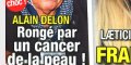 Alain Delon, le choc, "rongé" par le cancer de la peau (photo)
