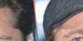 Brad Pitt, coup de jeune impressionnant, étonnante opération (photo)