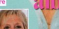 Brigitte Macron, sourire rectifié, physique changé, étonnante photo