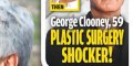 George Clooney, couple avec Amal sauvé - 20 ans de moins, chirurgie esthétique (photo)