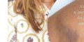 Iris Mittenaere, terrible blessure au bras - elle donne de ses nouvelles (photo)