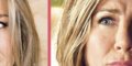 Jennifer Aniston, « visage déformé », désagréable raté chirurgical (photo)