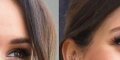 Prince Harry, Meghan Markle, étrange opération esthétique, coup de jeune impressionnant (photo)